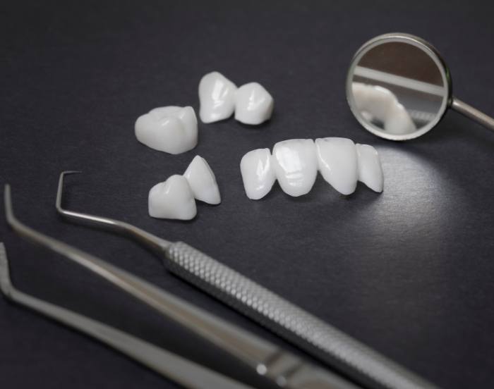 Several white dental crowns and veneers on a table next to dental instruments