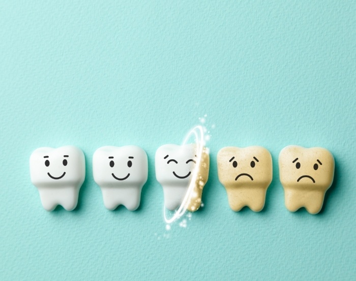 Illustration of row of frowning teeth being gradually turned white and smiling