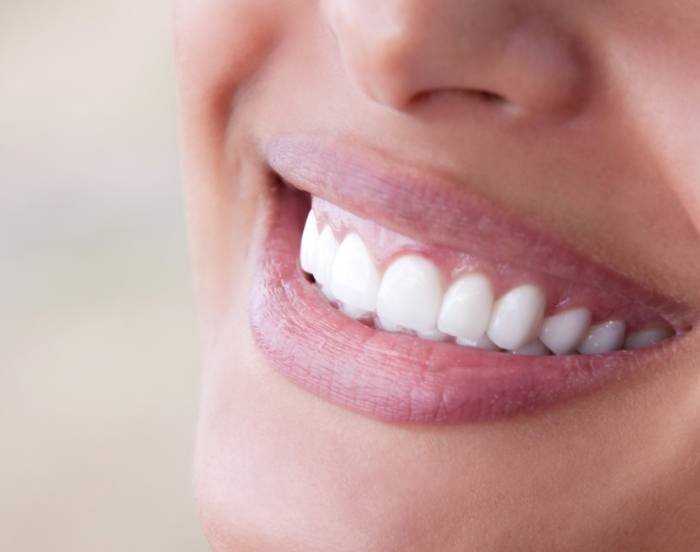 Close up of a smile with flawlessly straight white teeth