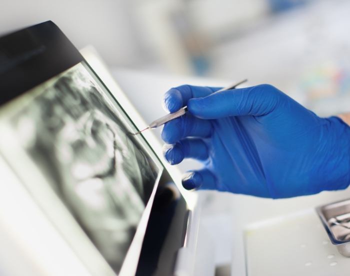 Dentist gesturing to a screen showing an x ray of teeth