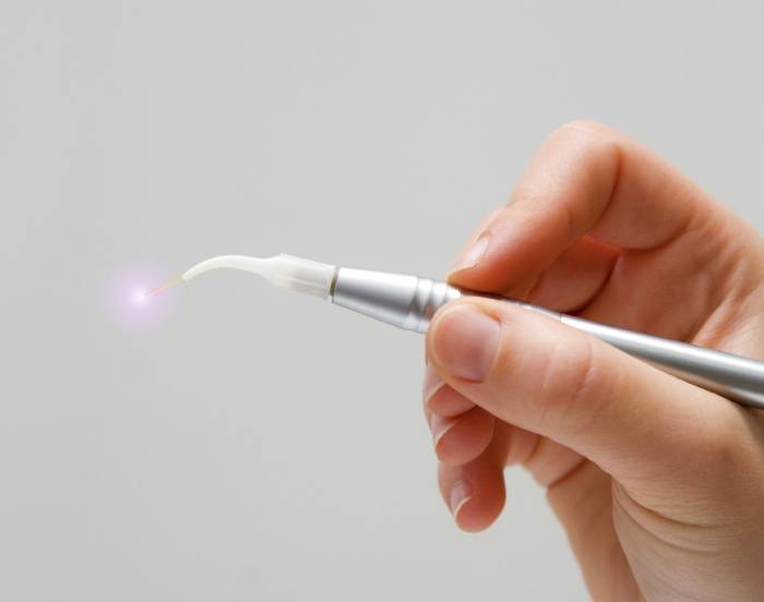 Hand holding a pen like dental laser device