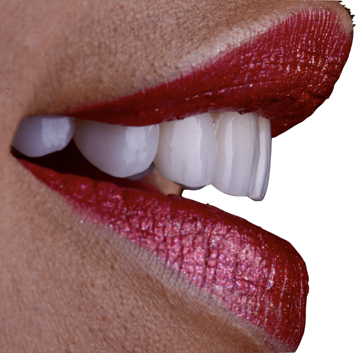 Close up side profile of a smile with red lips and flawless white teeth