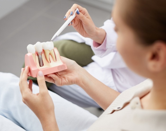 Dentist showing a model of a dental implant to a patient