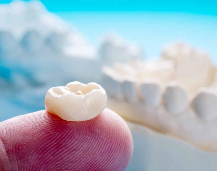 Close up of a dental crown resting on a finger